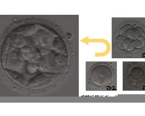 做试管看什么科室：做试管想要看看子宫环境