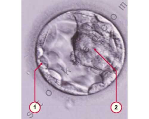试管婴儿初检结果多久出(试管婴儿初检结果多久出来)