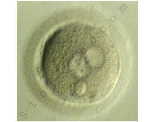 石家庄第四医院借卵中心做一次试管费用多少? 高龄供卵助孕费用多少