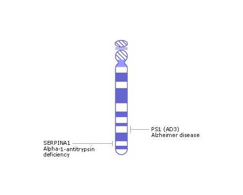 艾滋洗试管婴儿多少钱-艾滋洗试管婴儿多少钱