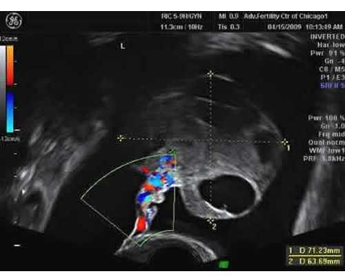 试管婴儿可以免费吗