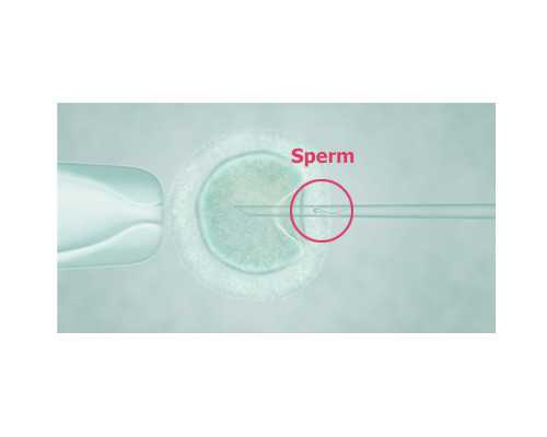 『孕吐的原因』怀孕七个月恶心想吐怎么回事