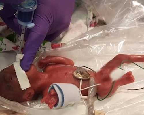 一条走了5年的求子路,终于上岸了,得到双胎 私人代孕费用