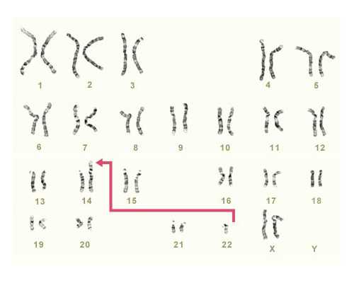 卵巢早衰喝这个,巨有用! 代孕付费流程