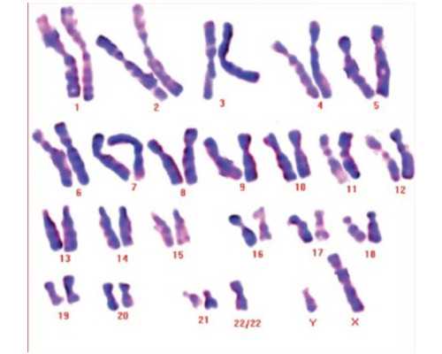 隔尿垫巾使用方法(隔尿垫巾有必要买吗) 代孕哪家专业