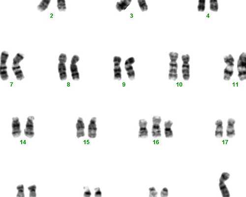 【备孕1】夫妻双方染色体核型分析 专业代孕咨询